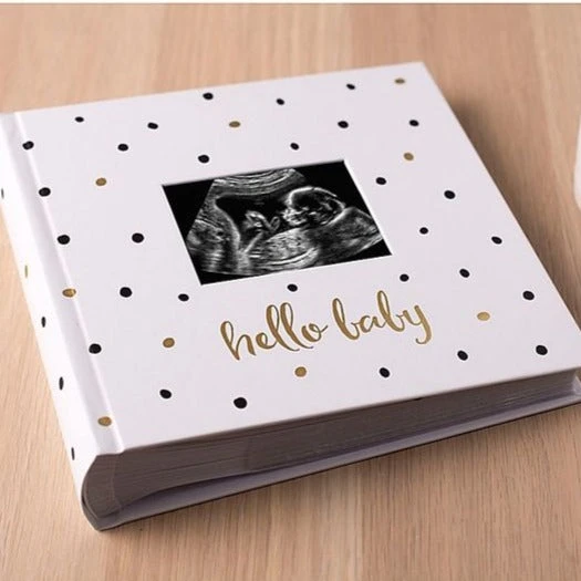 Pearhead Hello Baby Babybook - Black & Gold 2 Pearhead Hello Baby Babybook - Black & Gold - Image 2